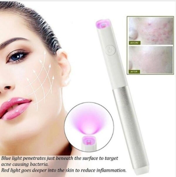 Household Safety Red Blue Light Smallpox Diluting Acne Beauty Instrument - Image 2